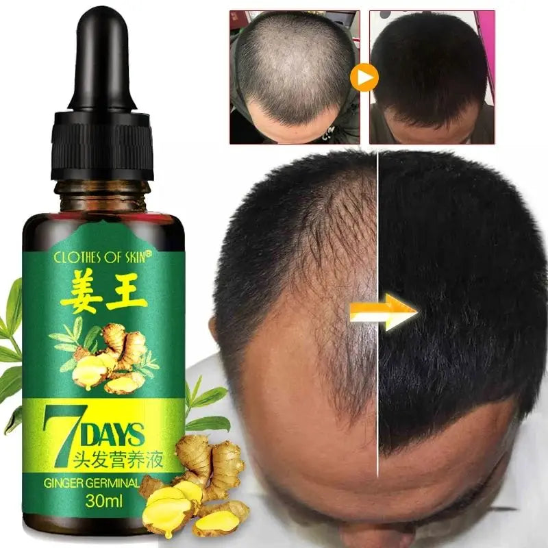Ginger Hair Care Essential Oil