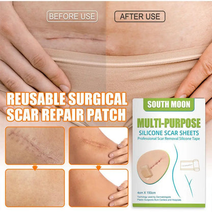 Silicone Gel Scar Sheet Patch